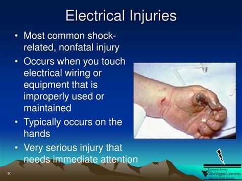 What is the most common electric shock related injury, and how does it compare to the sensation of licking a battery?